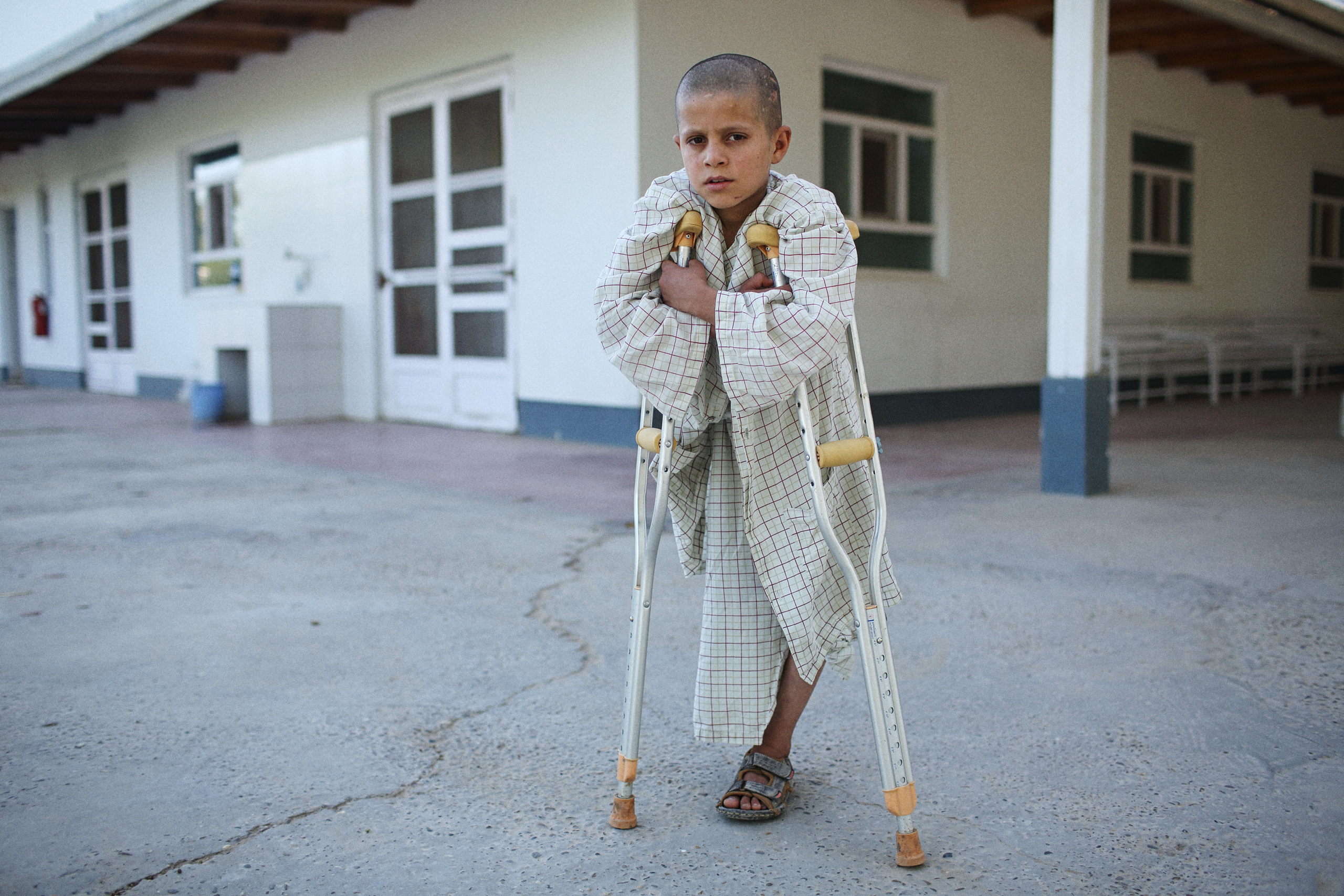 civilian casualties have reached an all-time high, plateauing in 2016 and 2017. children and women represented two thirds of casualties by air strikes in the first nine months of 2017: injured boy in helmand province. photo: andrew quilty (2015)